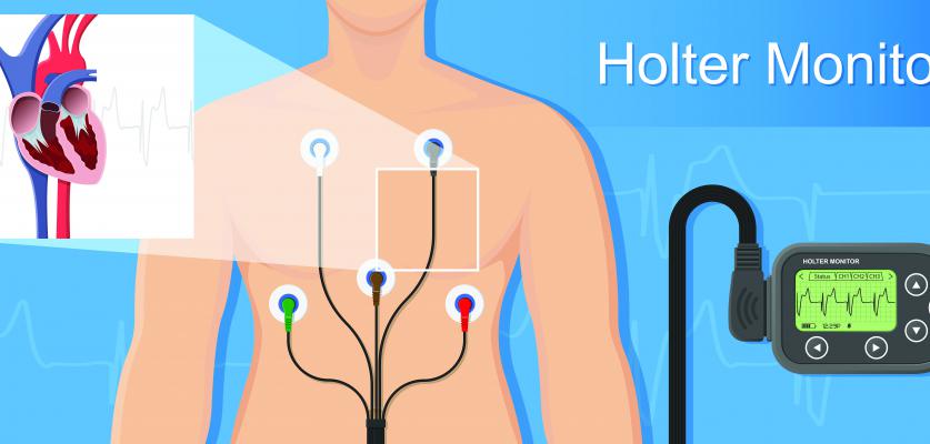 Se puede trabajar con un holter